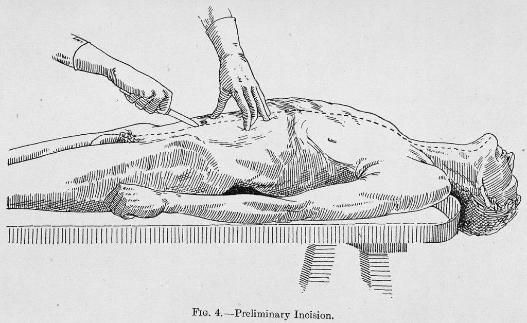 Preliminary incision.